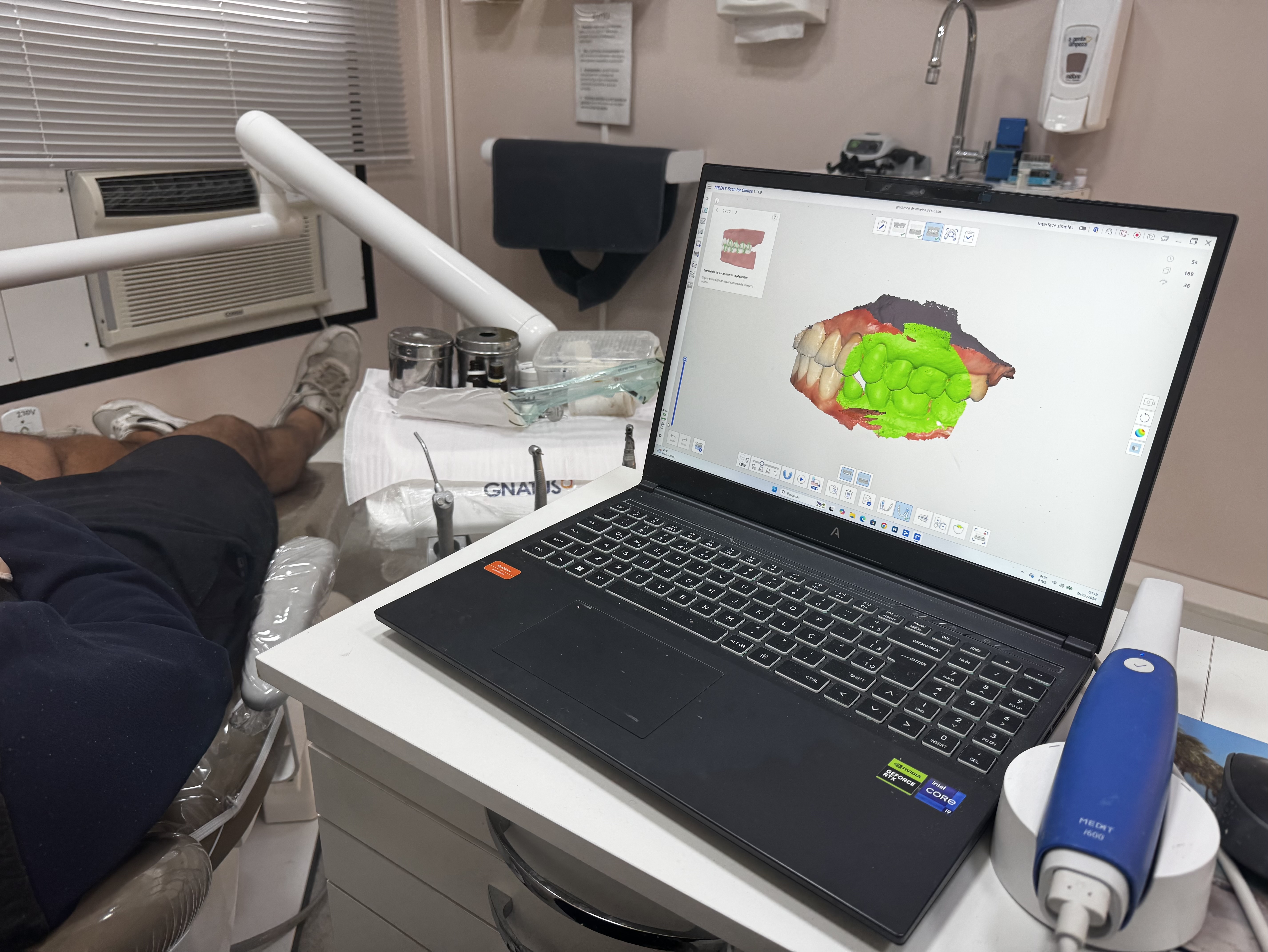 Equipamento de Odontologia Digital
